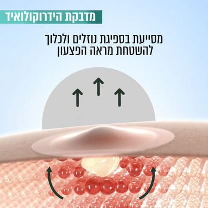 גרנייה מדבקות הידרוקולואיד