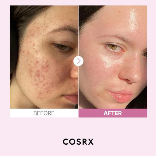 Cosrx The Niacinamide 15 Serum
