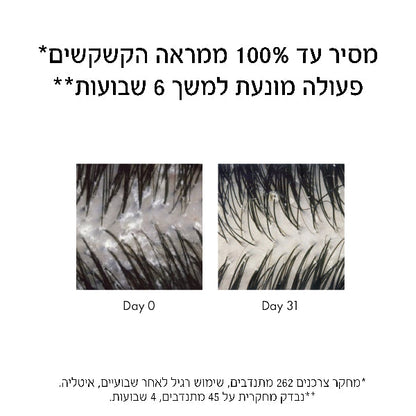 דרקוס שמפו נגד קשקשים לשיער יבש 390 מ"ל - וישי