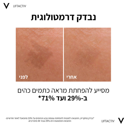 סרום B3 לטיפול בכתמים וקמטים | 30 מ"ל | Vichy
