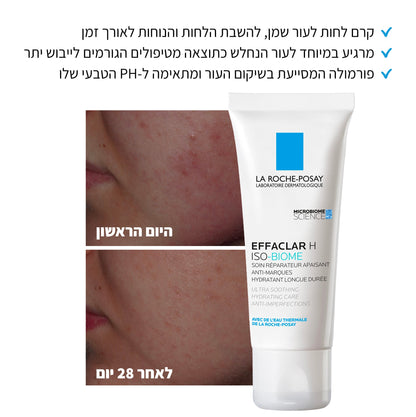 קרם פנים 'אפקלאר H' לעור שמן הנוטה לפצעונים ואדמומיות 40 מ"ל | La Roche-Posay