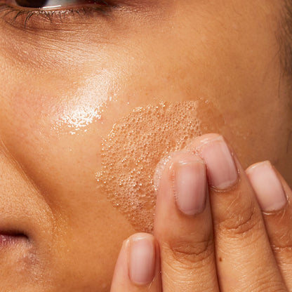 ג'ל ניקוי לטיפול בפגמים בעור פנים שמן הנוטה לפצעונים 473 מ"ל | CeraVe