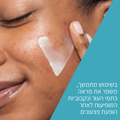 סרום רטינול מתקדם לחידוש מראה עור הפנים לאחר אקנה | 30 מ"ל | CeraVe