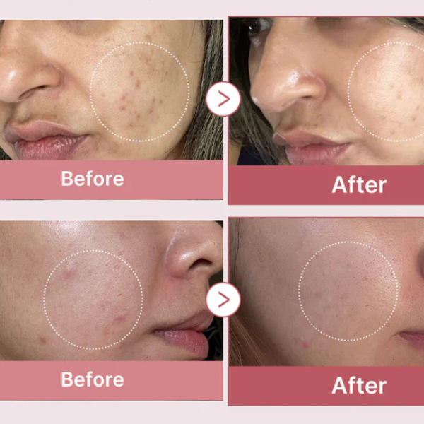 Medicube PDRN Pink Peptide Serum