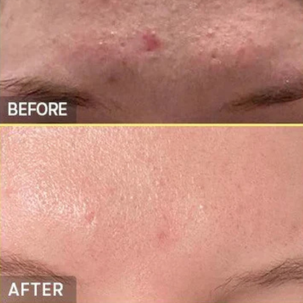  קוסרקס תמצית חלזונות להענקת לחות לעור