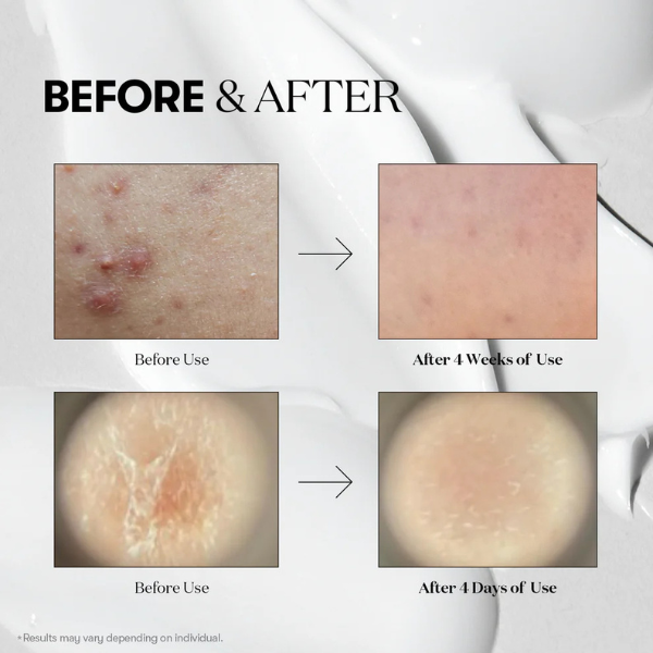 VT Microneedling Serum Reedle Shot 100