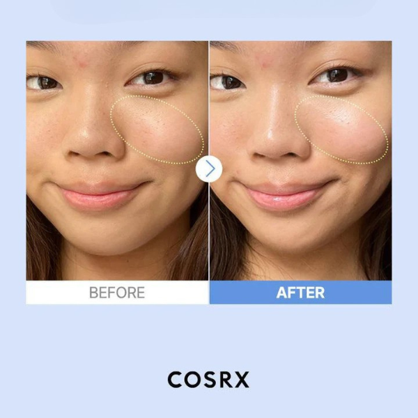 The Hyaluronic Acid 3 Serum Cosrx 