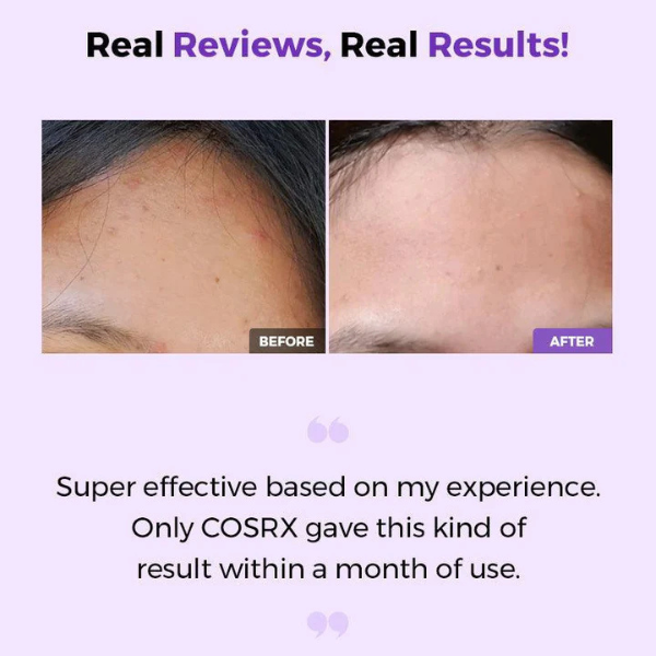 COSRX CLARIFYING TREATMENT TONER
