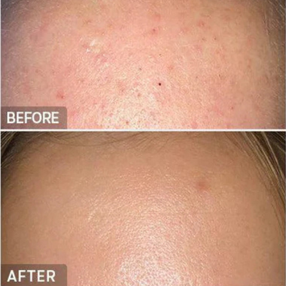 BHA Blackhead Power Liquid Cosrx 