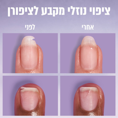 טיפול נוזלי לתיקון ציפורניים שבורות וסדוקות | 7 מ"ל | Essie