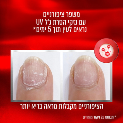 לק משקם ציפורניים 'טו דה רסקיו' - Essie